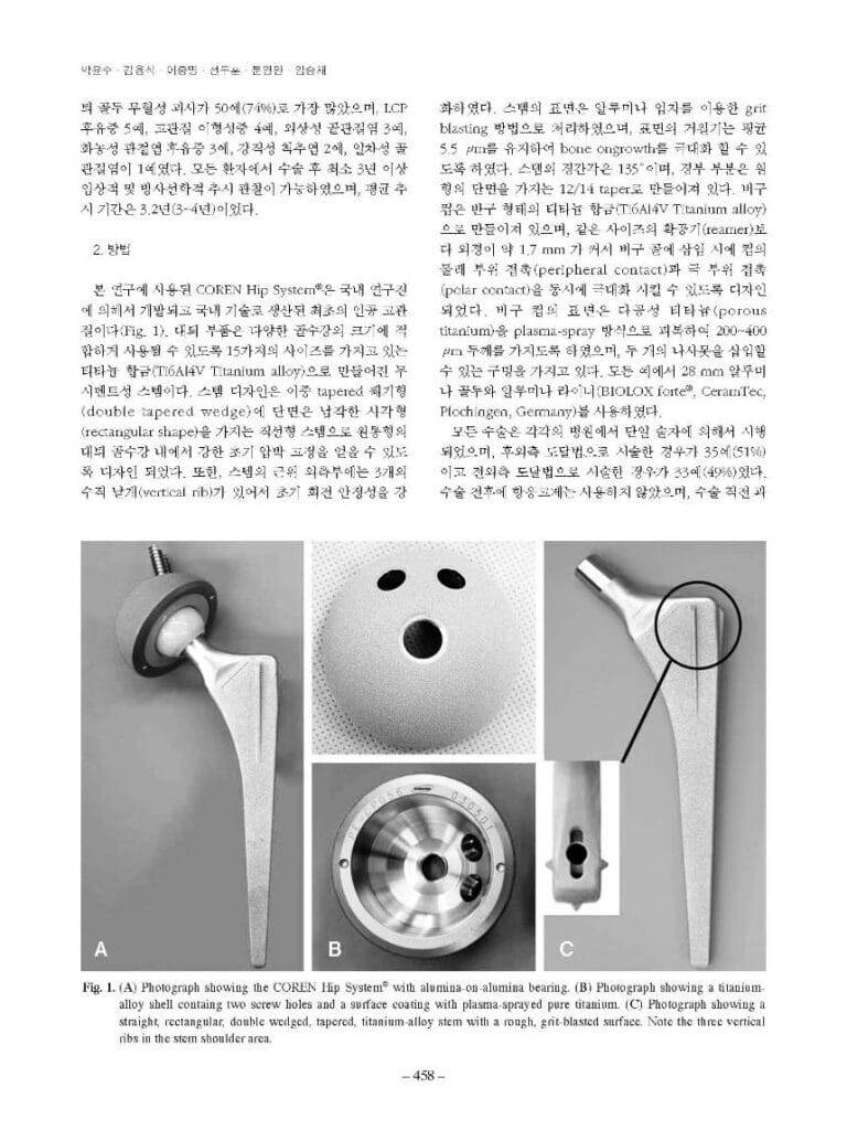 박윤수 등, COREN Hip system을 이용한 무시멘트 고관절 전치환술, 대한고관절학회지, 2007 - page 2