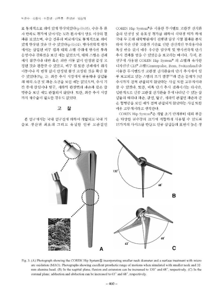 박윤수 등, COREN Hip system을 이용한 무시멘트 고관절 전치환술, 대한고관절학회지, 2007 - page 4