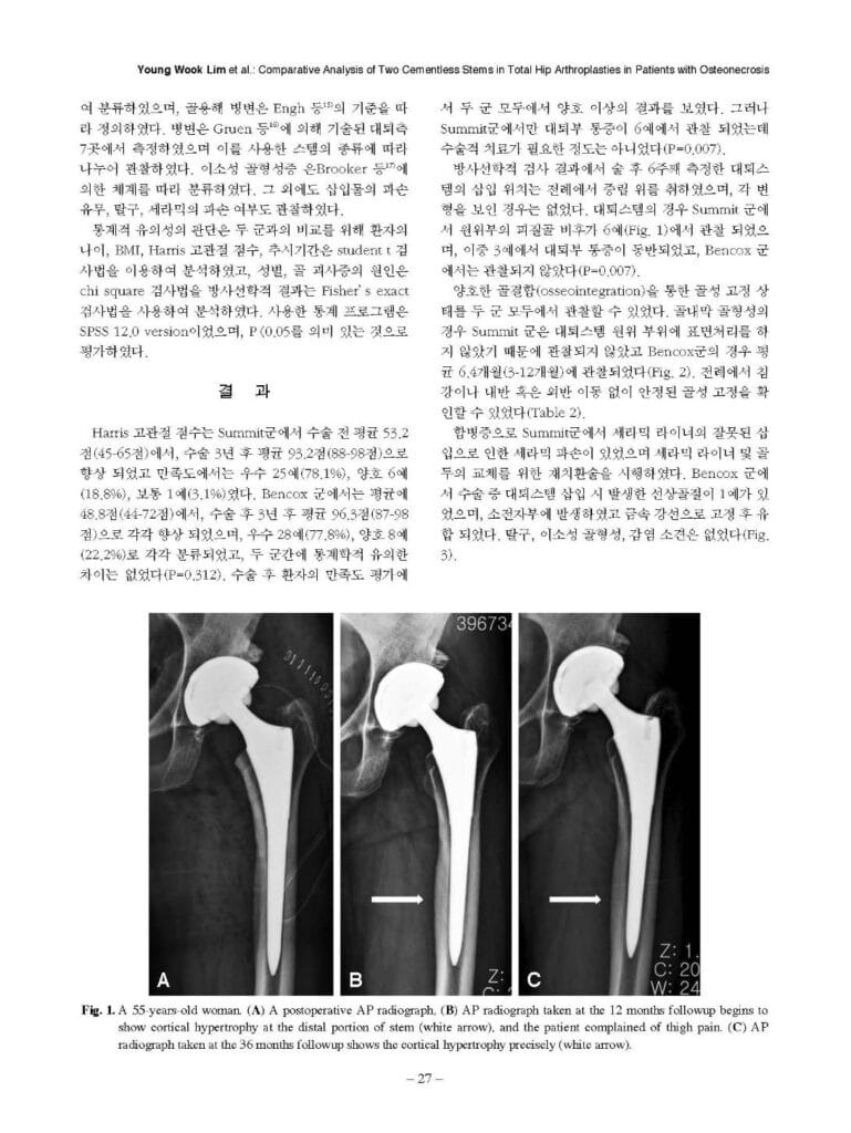 YW Lim et al., Comparative Analysis of Two Cementless Stems in Total Hip Arthroplsties in Patients with Osteonecrosis, J Korean Hip Soc., 2012 - page3