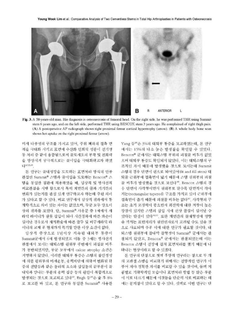 YW Lim et al., Comparative Analysis of Two Cementless Stems in Total Hip Arthroplsties in Patients with Osteonecrosis, J Korean Hip Soc., 2012 - page5