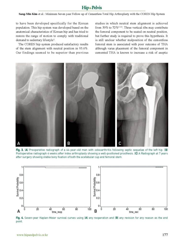 SM Kim et al., Minimum Seven-year Follow-up of Cementless THA with the COREN Hip System, Hip&Pelvis, 2013 - page 5