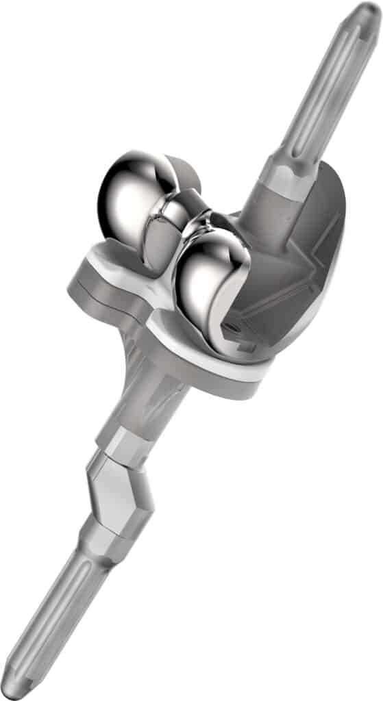 Lospa Revision System