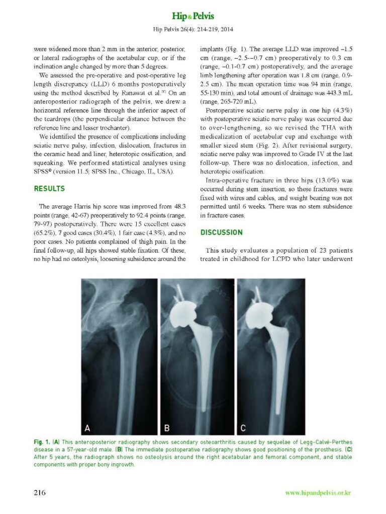 YW Lim et al., THA in Patient with the Sequelae of Legg-Calve-Perthes Disease, Hip&Pelvis, 2014 - page 3